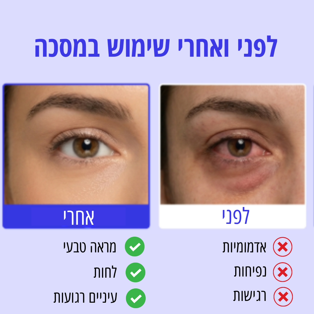 מסיכת חימום סטרילית להרגעה והקלה מיידית לעיניים יבשות ומגורות