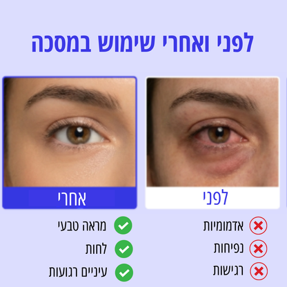 מסיכת חימום סטרילית להרגעה והקלה מיידית לעיניים יבשות ומגורות