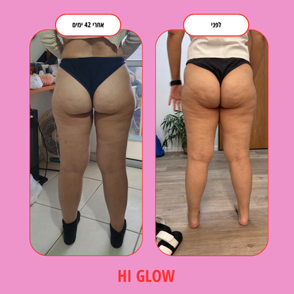 ערכת GlowFlow- התחייבות לתוצאות נראות לעין תוך 45 יום