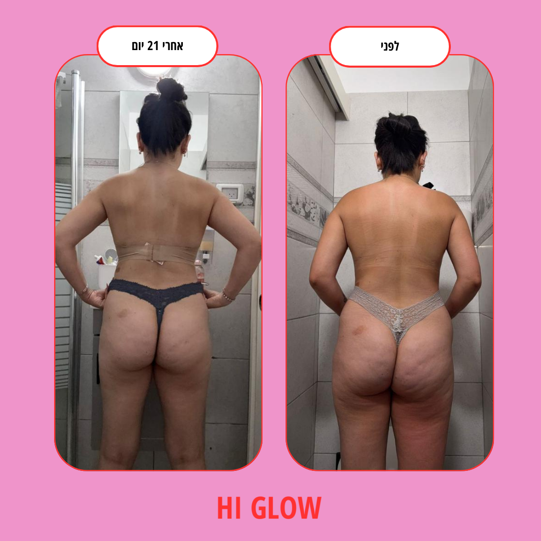 ערכת GlowFlow- התחייבות לתוצאות נראות לעין תוך 45 יום