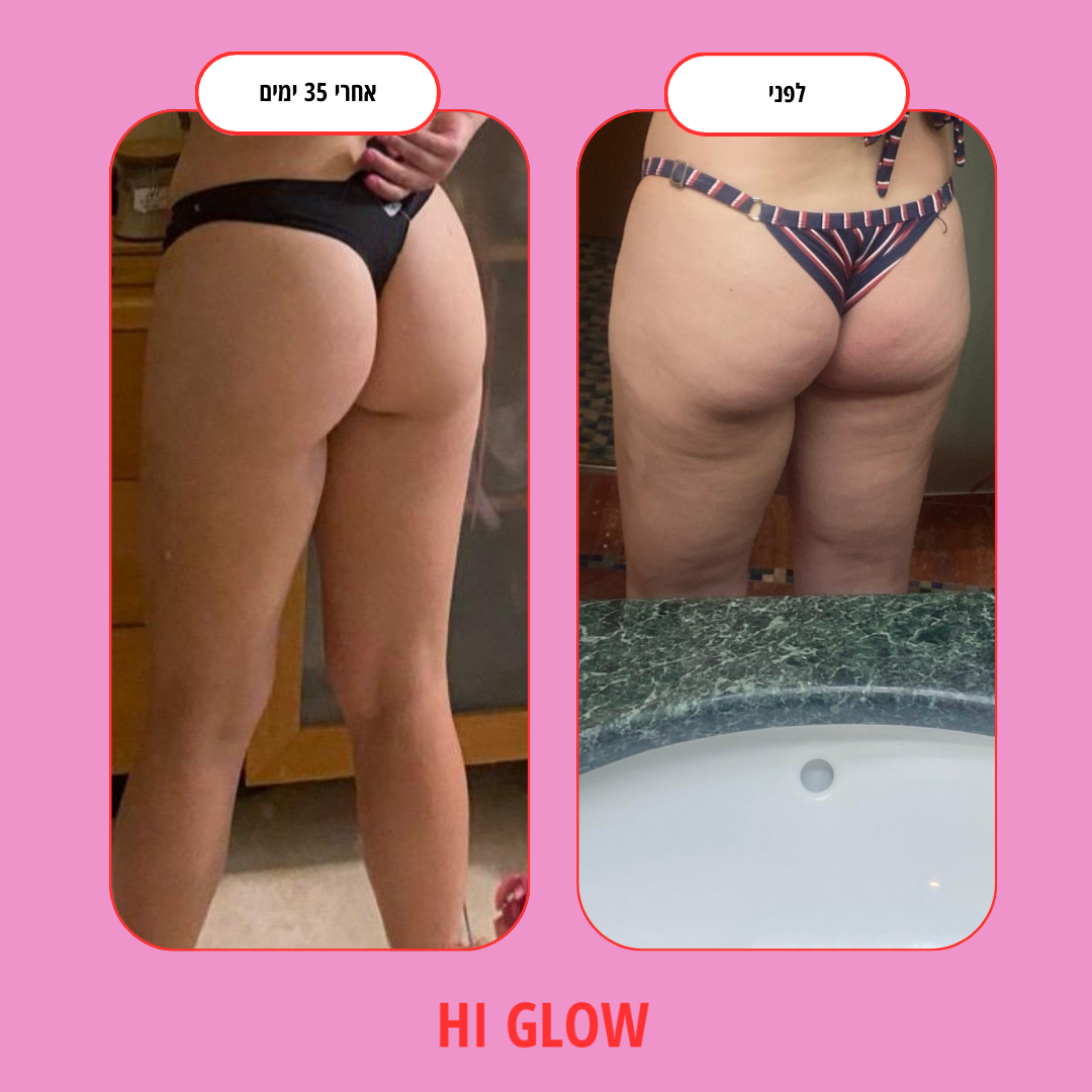 ערכת GlowFlow- התחייבות לתוצאות נראות לעין תוך 45 יום