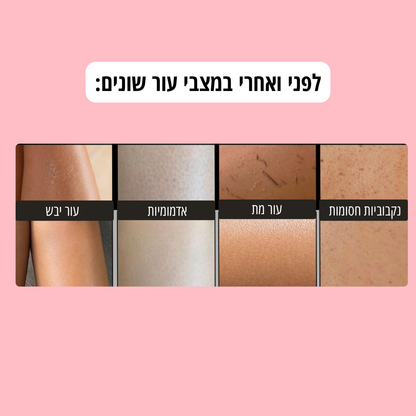 כפפת פילינג  HIGLOW לעור זוהר וחלק