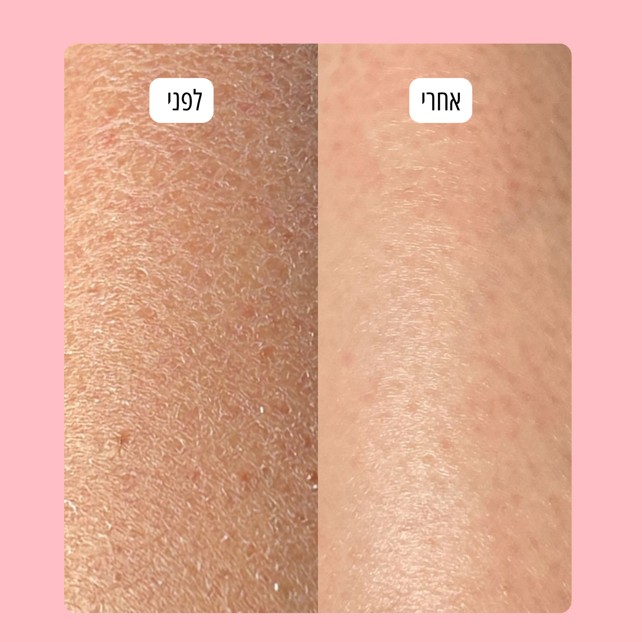 כפפת פילינג  HIGLOW לעור זוהר וחלק