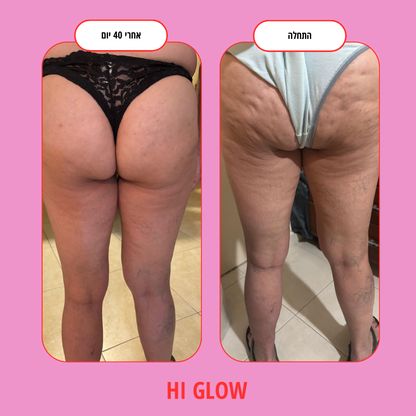 ערכת GlowFlow- התחייבות לתוצאות נראות לעין תוך 45 יום