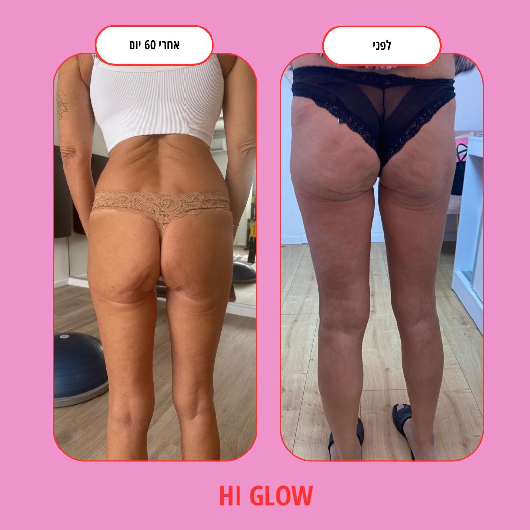 ערכת GlowFlow- התחייבות לתוצאות נראות לעין תוך 45 יום