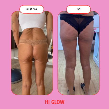ערכת GlowFlow- התחייבות לתוצאות נראות לעין תוך 45 יום